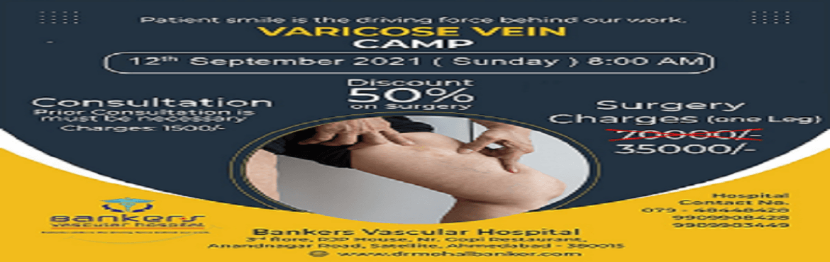Varicose Vein Camp