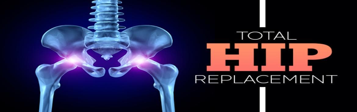 Total Hip Replacement | Post Hip And Knee Replacement Care Services | Total Knee Replacement